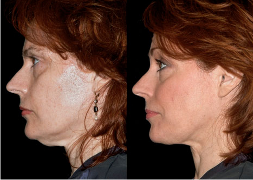Dr. Roller Skin Treatment Success Stories